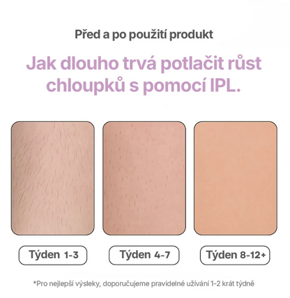 HAIRLESS: IPL Laserový Odstraňovač Chloupků